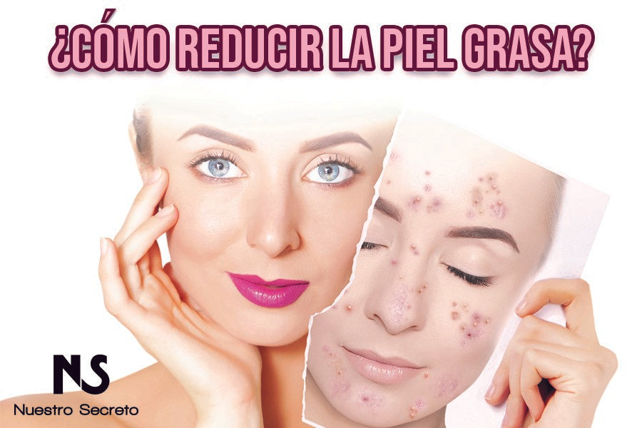 ¿Cómo reducir la grasa de la piel? Cremas y mascarillas para piel grasa.