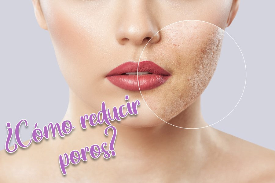 ¿Cómo Reducir Poros?