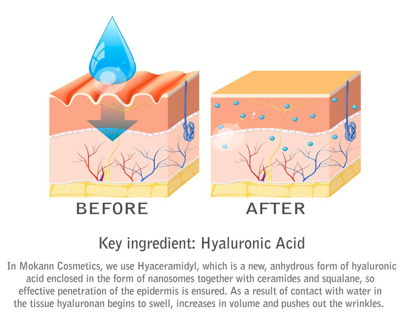 Hyaluronicacidwithtext_191a2873-aea3-4de5-aa68-c59f767c25af